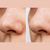 Eclear Anti Acne Face Wash Gel 60mL
